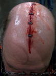 Headwound 2.jpg