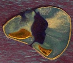 Atoll detail